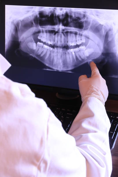 Best Emergency Dentist for Lost Fillings or Crowns in Louisville, OH