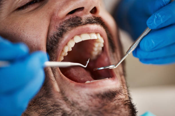 Best Pediatric Emergency Dentist in Louisville, OH